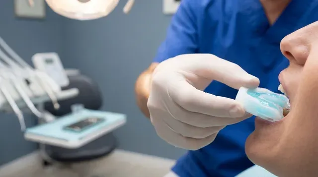 The Science Behind Fluoride Treatments