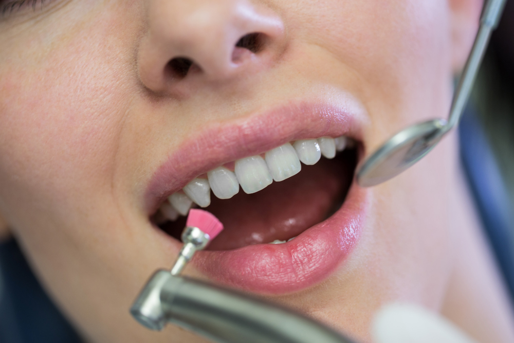 Cosmetic Dentistry